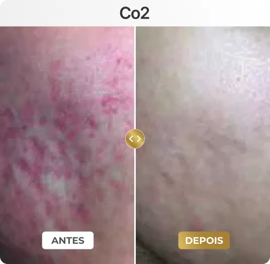 co3