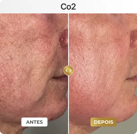 co6
